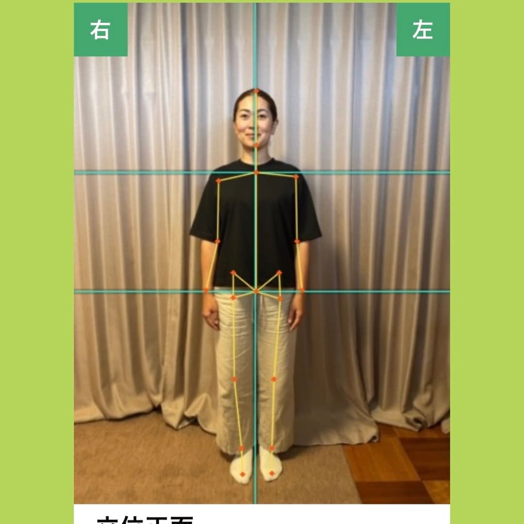 AI診断